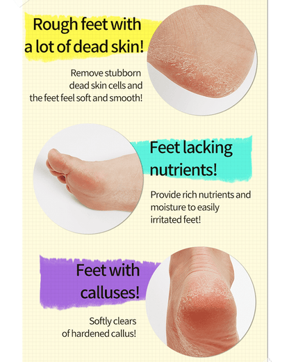 A'pieu Soft Foot 30Minute Peeling Socks